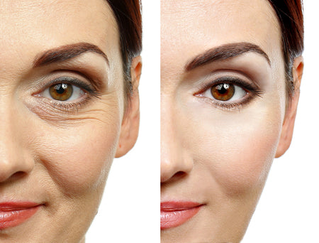 MASAJEADOR FACIAL ANTI ARRUGAS Y ANTIPAPADA